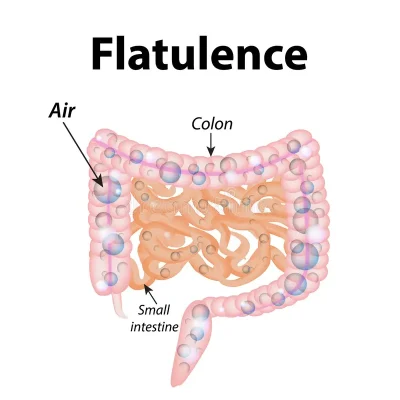flatulence gases small intestine gases colon air structure 72790112