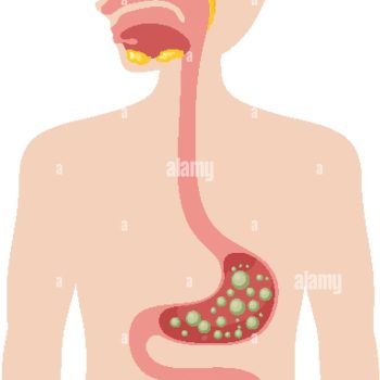 vector illustration of human digestive system highlighting bloating and gas simplified anatomy with clear muted colors and clean lines 3dcjrj6